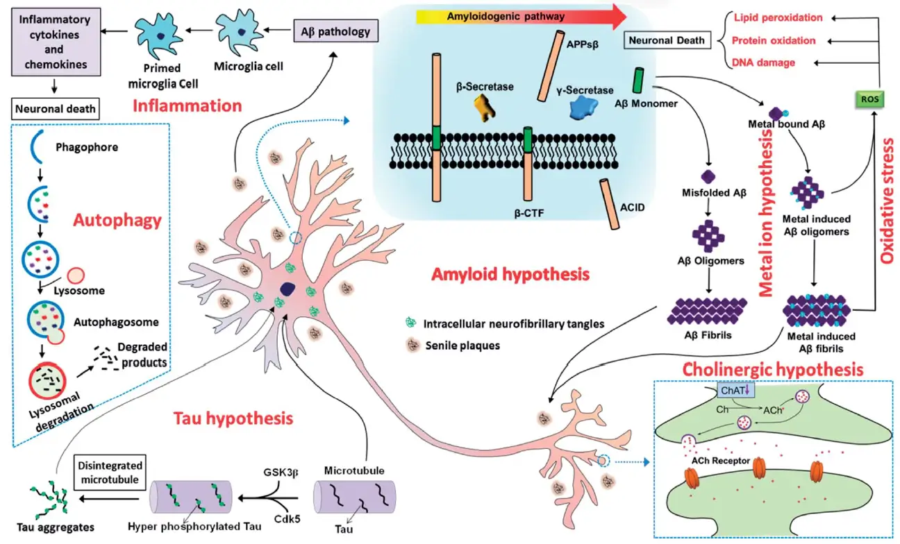阿尔茨海默病的多种病理机制.webp